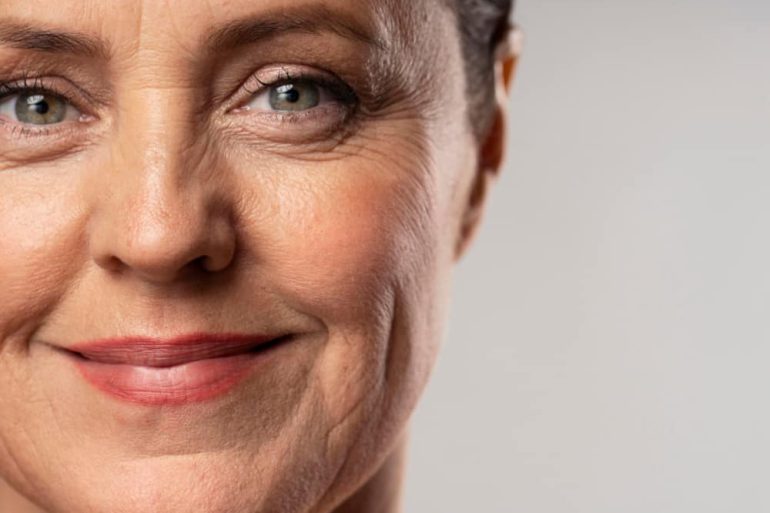 tegen rimpels, wat helpt